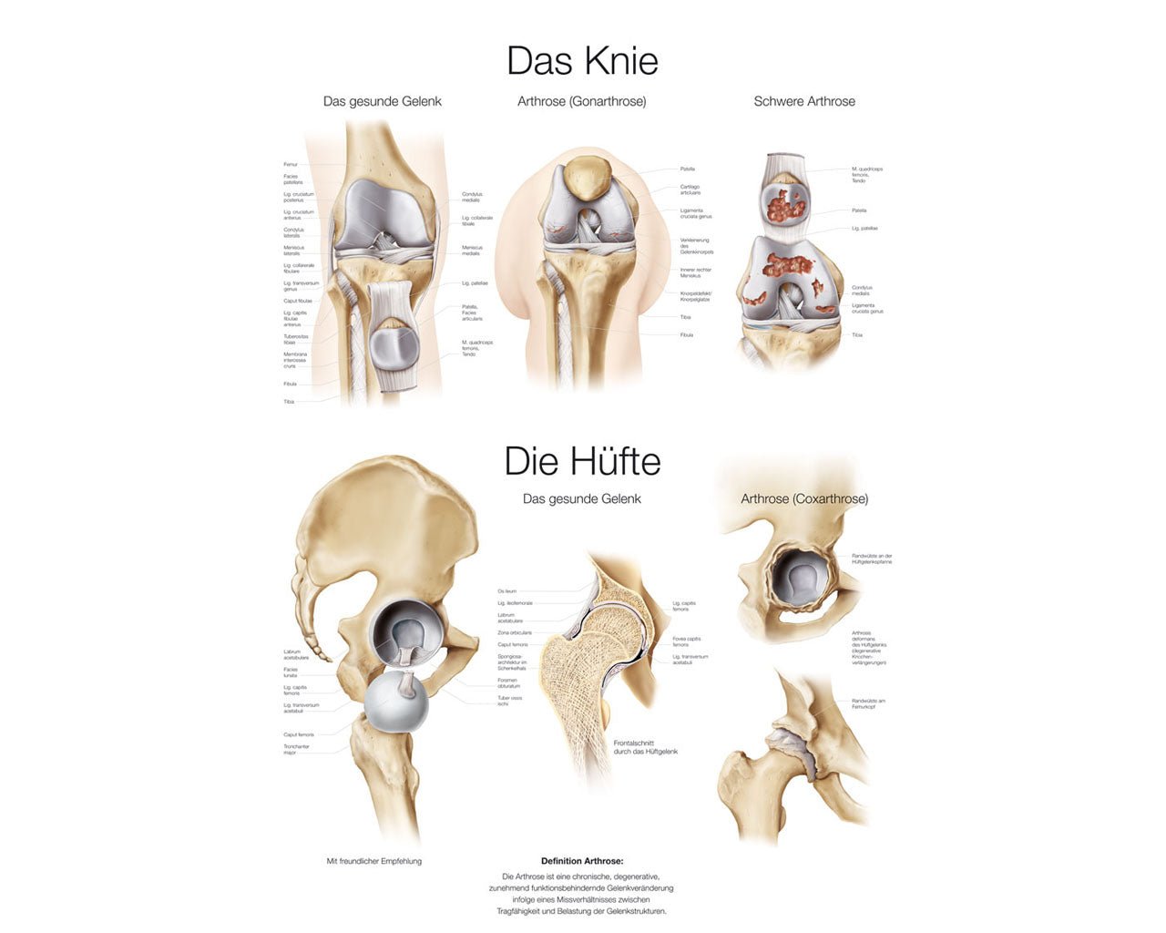 Lehrtafel das Knie, die Hüfte - ErlerZimmer - ppw - winter