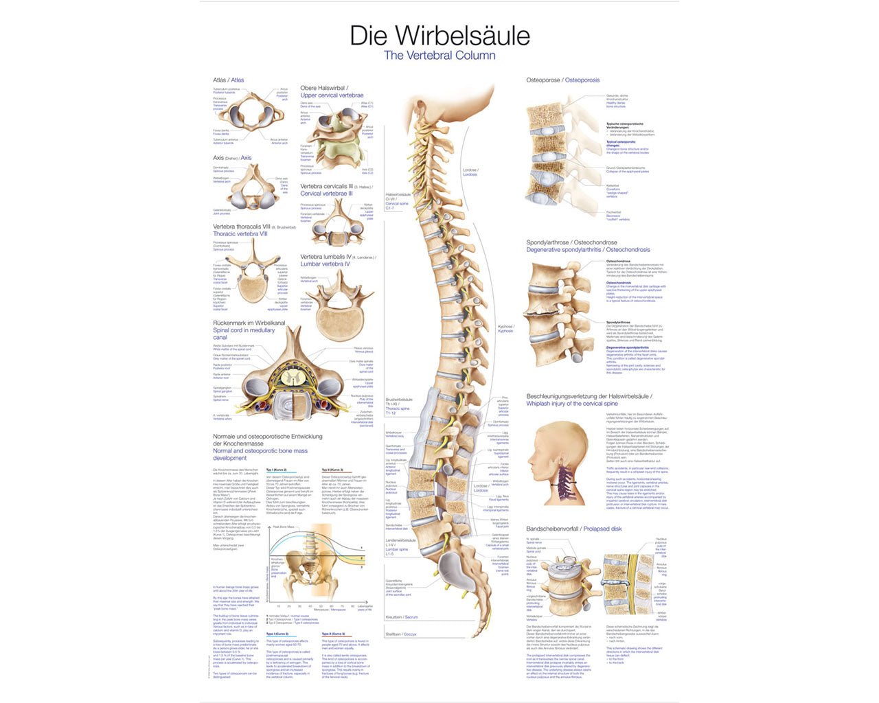 Lehrtafel die Wirbelsäule - ErlerZimmer - ppw - winter